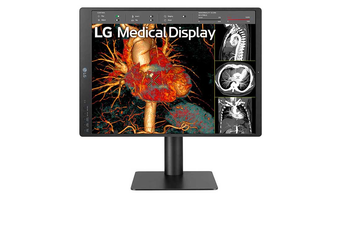 LG 21'' Medical Monitor - Wholesales Supply